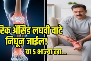 Foods to Lower Uric Acid