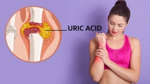 Uric Acid: किडनी व हाडांसाठी घातक ठरणारं युरिक ऍसिड ‘या’ रोजच्या सवयींमुळे वाढतं; आजच करा हे सोपे बदल