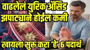 Uric Acid Home Remedies