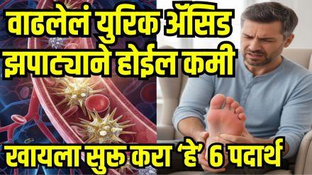 Uric Acid Home Remedies