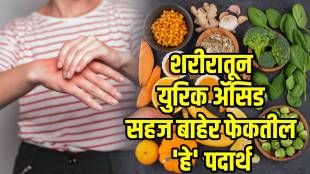 What is the food cause of uric acid