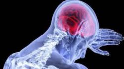 World Stroke Day 2025 : मेंदूविकाराचा झटका वेळेत ओळखलात तरच वाचाल! भारतात दरवर्षी १८ लाख रुग्णांची नोंद, पाचपैकी एकाचा मृत्यू…