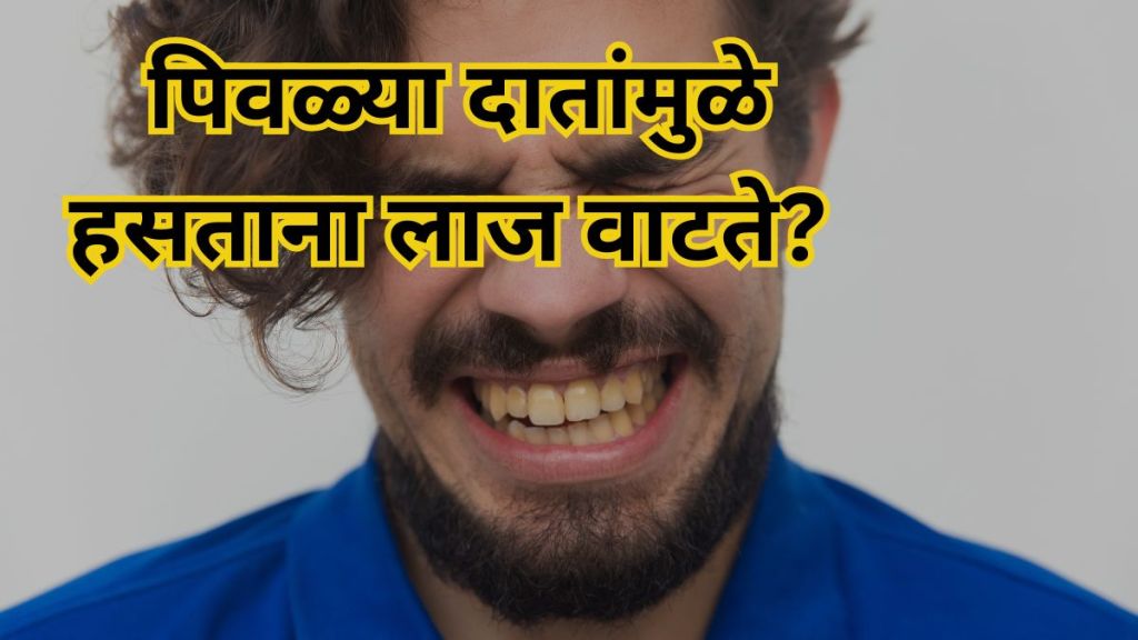 Yellow Teeth Yellow Teeth