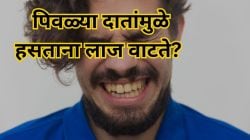 पिवळ्या दातांमुळे मोकळेपणाने हसू शकत नाही? केमिकलयुक्त टूथपेस्टऐवजी या ५ आयुर्वेदिक वनस्पतीं वापरा, दात होतील मोत्यासारखे पांढरे!
