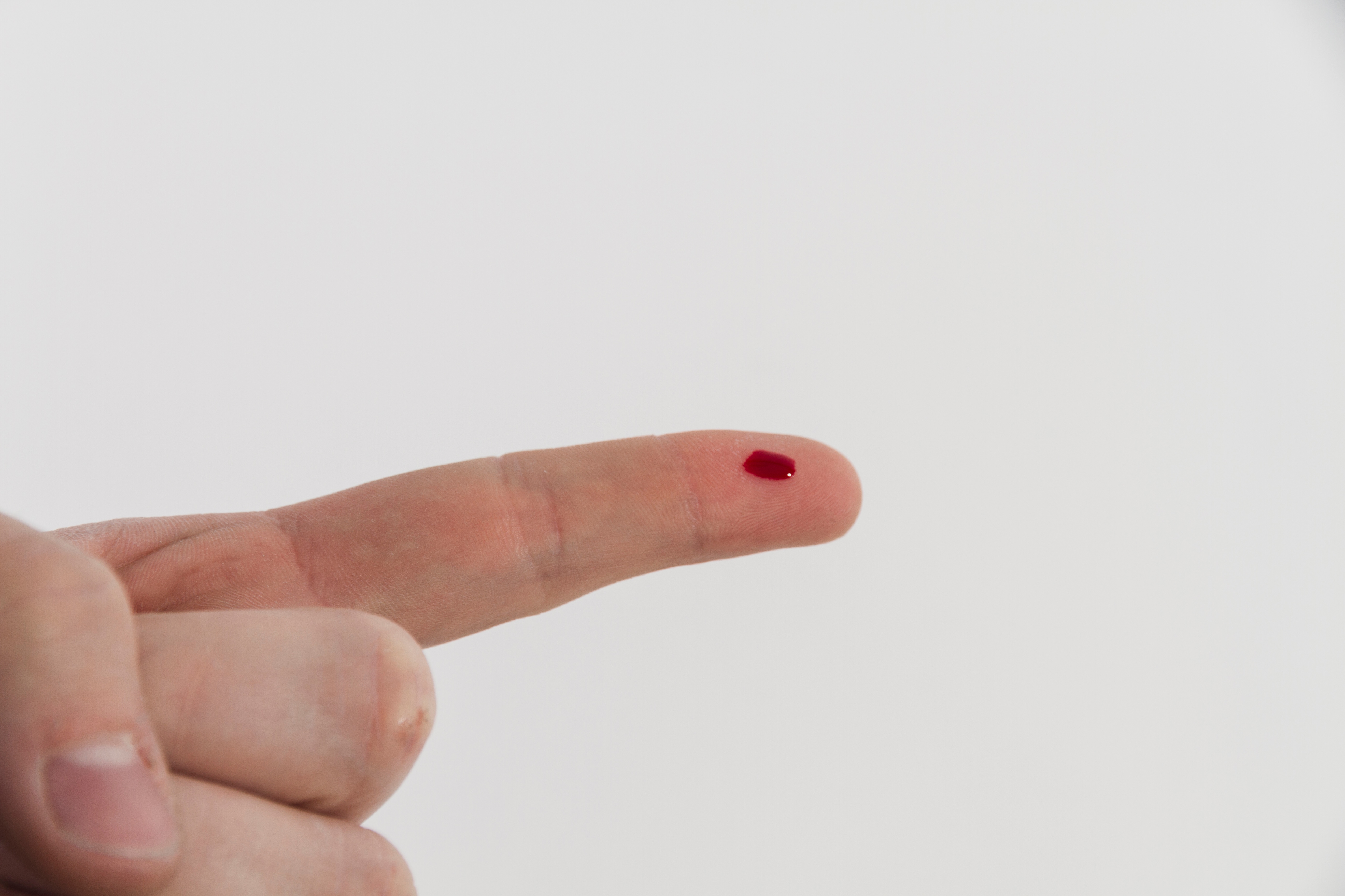 Blood in urine can be an early sign of kidney cancer