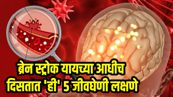 Brain Stroke Symptoms early signs of brain strokes in body stroke prevention doctor advice
