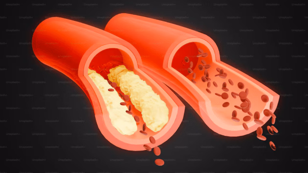 Calcium and heart health