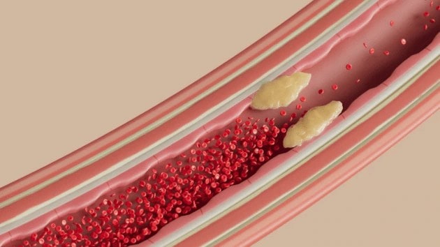 Calcium and heart health