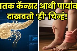 pancreatic cancer early signs