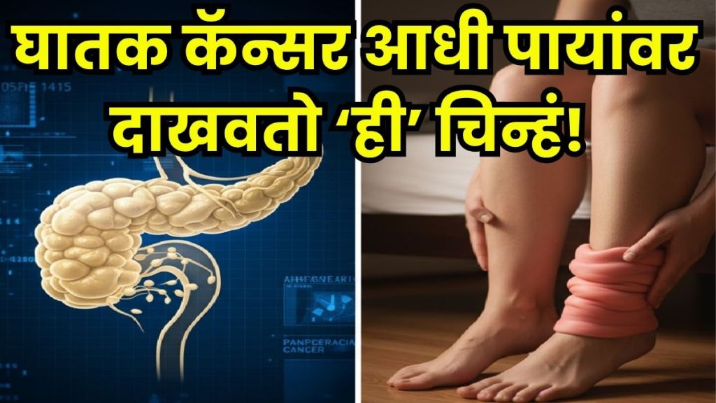 pancreatic cancer early signs pancreatic cancer early signs