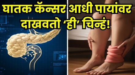 pancreatic cancer early signs pancreatic cancer early signs