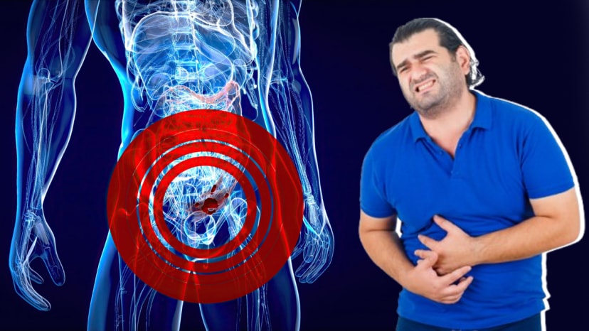 colon cancer symptoms in young people adults fruits for colon cancer causes and treatment