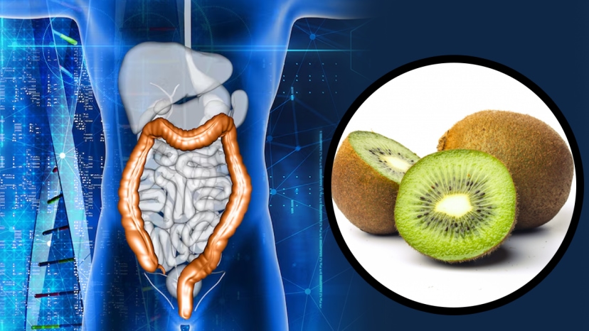colon cancer kiwi