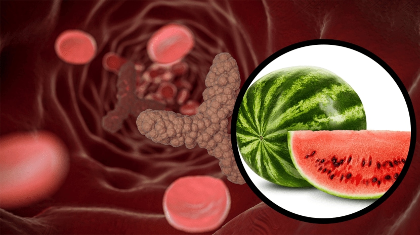colon cancer watermelon