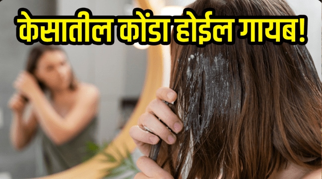 Dandruff hair mask diy apple cider vinegar for dandruff Best anti dandruff hair mask