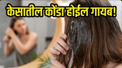 Dandruff Hair Mask: केसातील कोंडा होईल गायब! वापरा DIY अ‍ॅपल सायडर व्हिनेगर हेअर मास्क, जमा झालेली सगळी घाण निघून जाईल…
