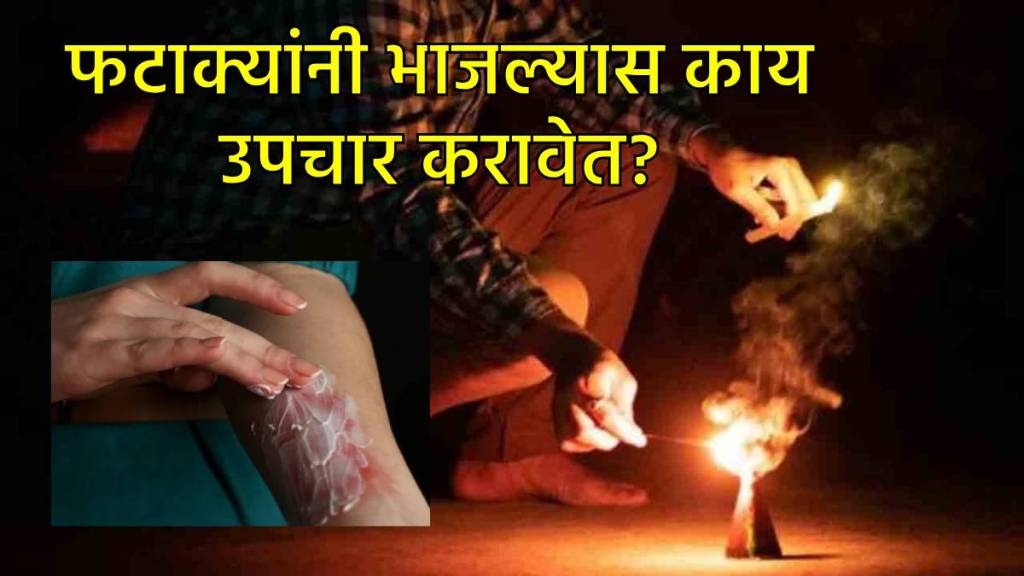फटाक्यांनी भाजल्यास त्वरित प्रथमोपचार कोणते?