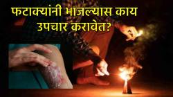 Diwali 2025: फटाक्यांनी भाजल्यावर कोणते प्रथमोपचार करावेत? त्वरित मिळू शकतो आराम…