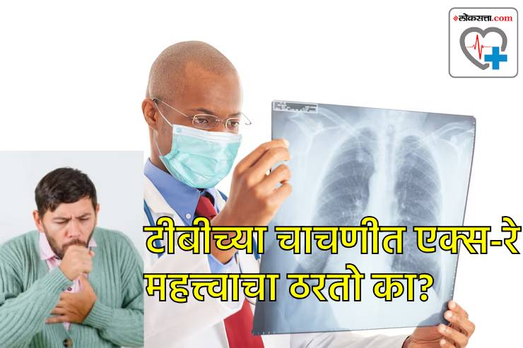 टीबीच्या रूग्णांच्या संपर्कात आल्याने संसर्ग होतो का? टीबीच्या रूग्णांच्या संपर्कात आल्याने संसर्ग होतो का?