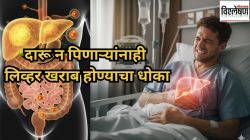 दारू न पिणाऱ्यांनाही लिव्हर खराब होण्याचा धोका; कारण काय? ‘या’ लक्षणांकडे अजिबात दुर्लक्ष करू नका