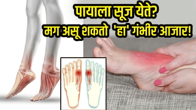 पायाला सूज येते? मुंग्याही येतात? मग असू शकतो ‘हा’ गंभीर आजार! दुर्लक्ष करू नका…