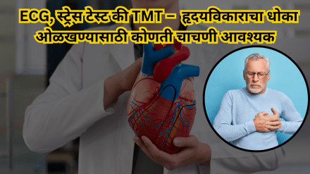 ECG, Stress Test or TMT Which test is necessary to identify the risk of heart disease