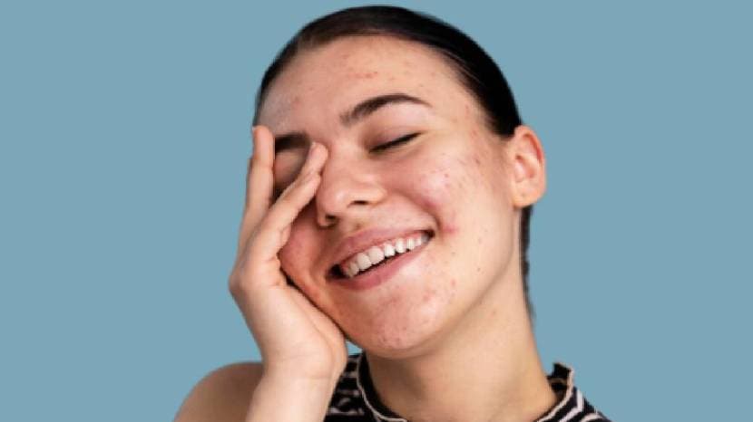 how-to-apply-turti-on-face