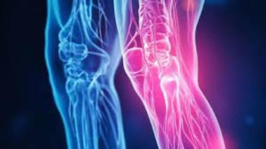 Rising Osteoarthritis in Young Adults Early Diagnosis Treatment for joint pain