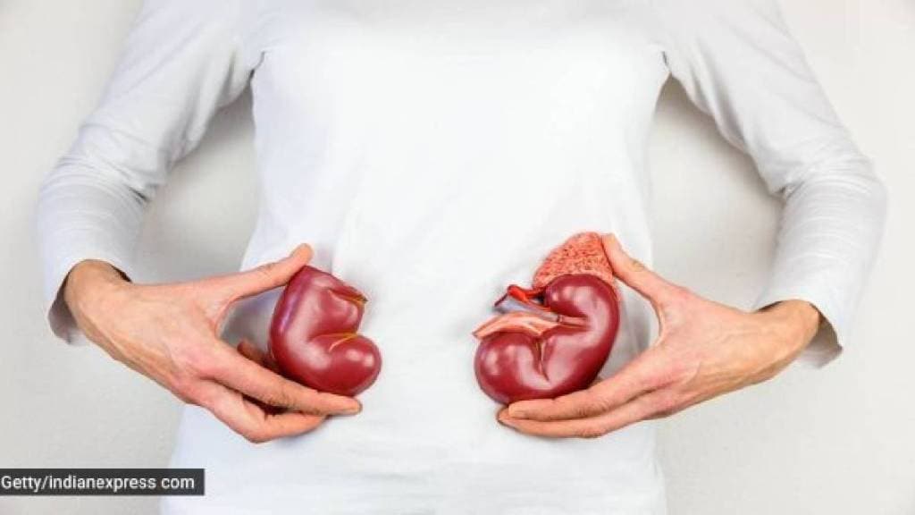The number of kidney cancer patients will double in the next 25 years