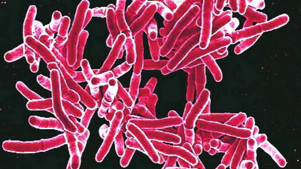 Loksatta kutuhal First record of tuberculosis in India Infectious diseases