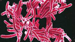 कुतूहल: क्षयाचा यक्षप्रश्न!