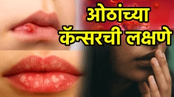 जास्त उन्हात राहिल्याने ओठांचा कॅन्सर होऊ शकतो! ओठावर दिसतात ‘ही’ लक्षणे, दुर्लक्ष करण्याची चूक करू नका…