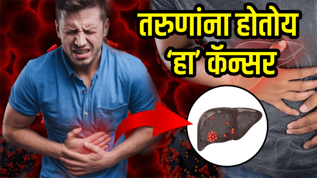 Liver cancer symptoms in young people adults rising 7 food habits reduce liver cancer causes and treatment Liver cancer symptoms in young people adults rising 7 food habits reduce liver cancer causes and treatment