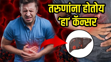 Liver cancer symptoms in young people adults rising 7 food habits reduce liver cancer causes and treatment