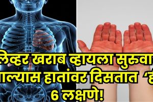Signs of Liver Damage