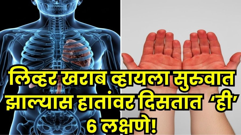Signs of Liver Damage