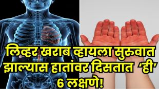 Signs of Liver Damage