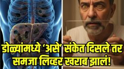 लिव्हर खराब झालं, तर आरशात पाहताना डोळ्यांत दिसतात ‘ही’ लक्षणे; अजिबात दुर्लक्ष करू नका नाही तर…