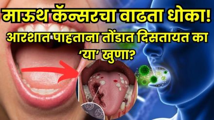 Mouth Ulcers Cancer Risk Mouth Ulcers Cancer Risk