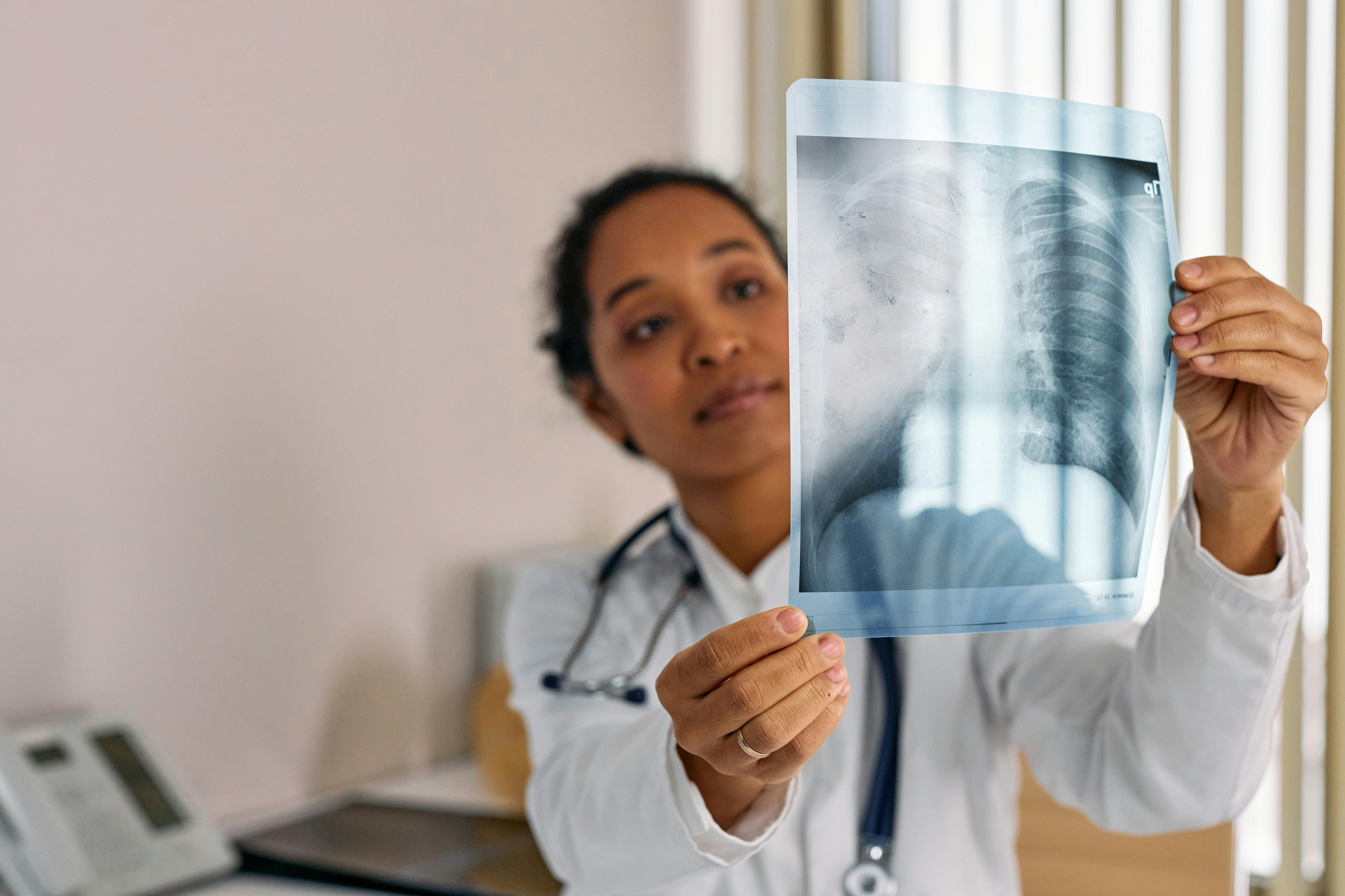 Lung cancer symptoms on fingers