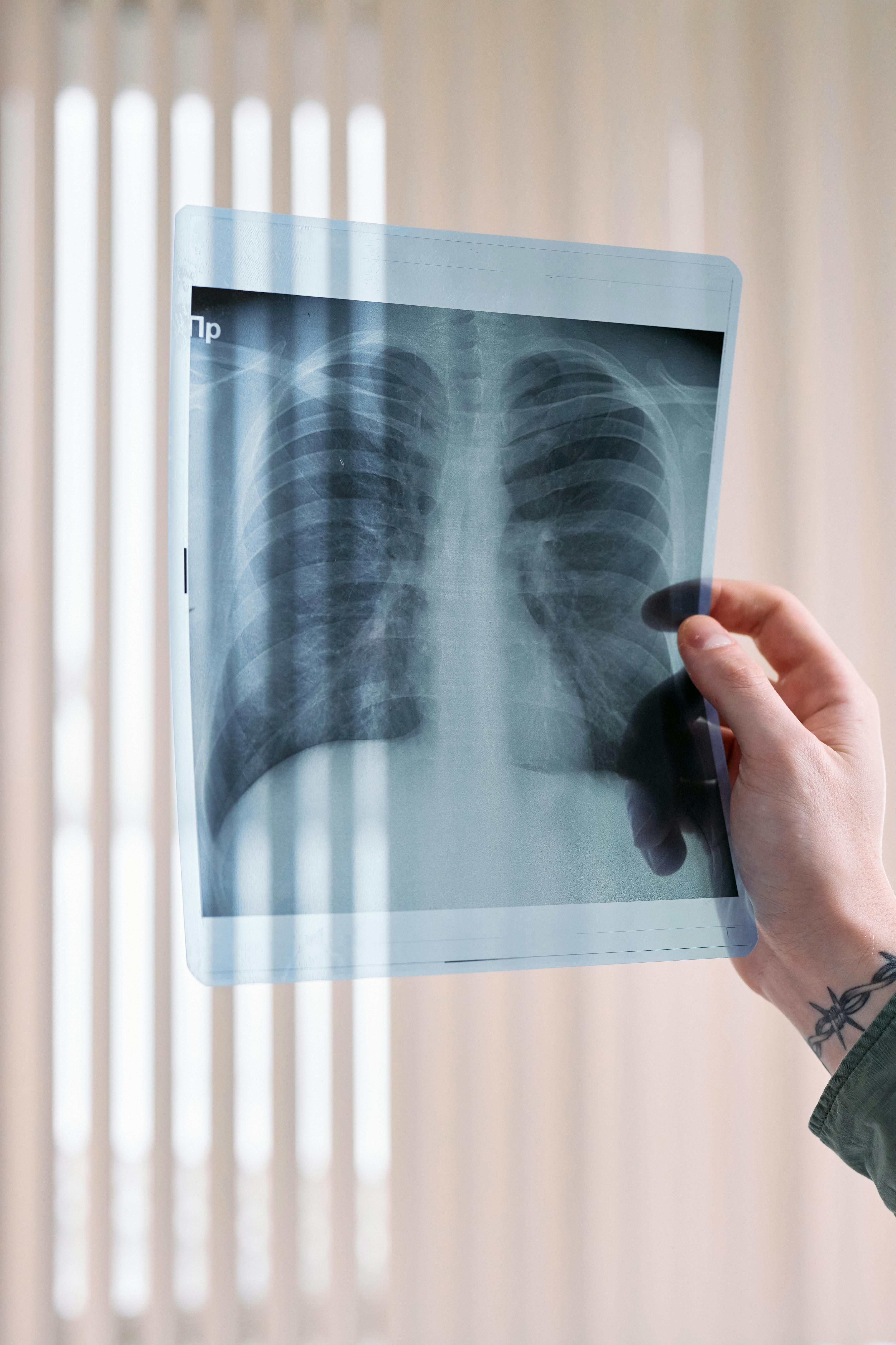 Lung cancer symptoms on fingers