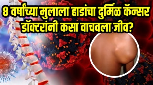 8 year old boy fought with Rare cancer bones ewings sarcoma doctor explained treatment