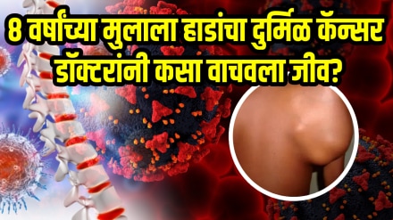 8 year old boy fought with Rare cancer bones ewings sarcoma doctor explained treatment 8 year old boy fought with Rare cancer bones ewings sarcoma doctor explained treatment