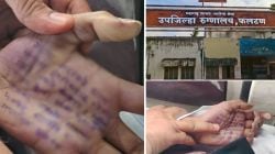 डॉक्टर तरूणीच्या आत्महत्येनंतर भावाचा मोठा आरोप; म्हणाला, ‘मेडिकल रिपोर्ट बदलण्यासाठी बहिणीवर होता दबाव’