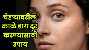 Try these 3 dermatologist-recommended ways to get clear and spotless skin.