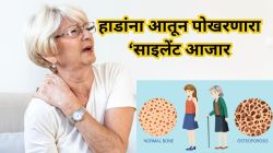 हाडांना आतून पोखरतो हा आजार! हात-पाय वांरवार फ्रॅक्चर होतात? दात सैल होतायत?; ‘साइलेंट आजार’ असू शकतो यामागचे कारण