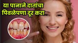 दात पिवळे झालेत? कीड लागलीय? मग घरच्याघरी करा ‘हा’ स्वस्तात मस्त उपाय, हिरड्यांचे दुखणेही थांबेल…