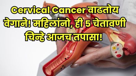 Cervical cancer symptoms Cervical cancer symptoms