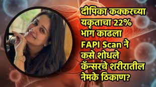 Dipika Kakar liver cancer