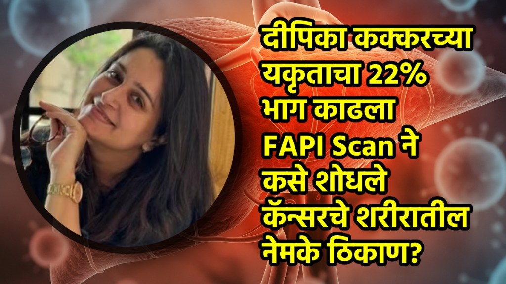 Dipika Kakar liver cancer Dipika Kakar liver cancer